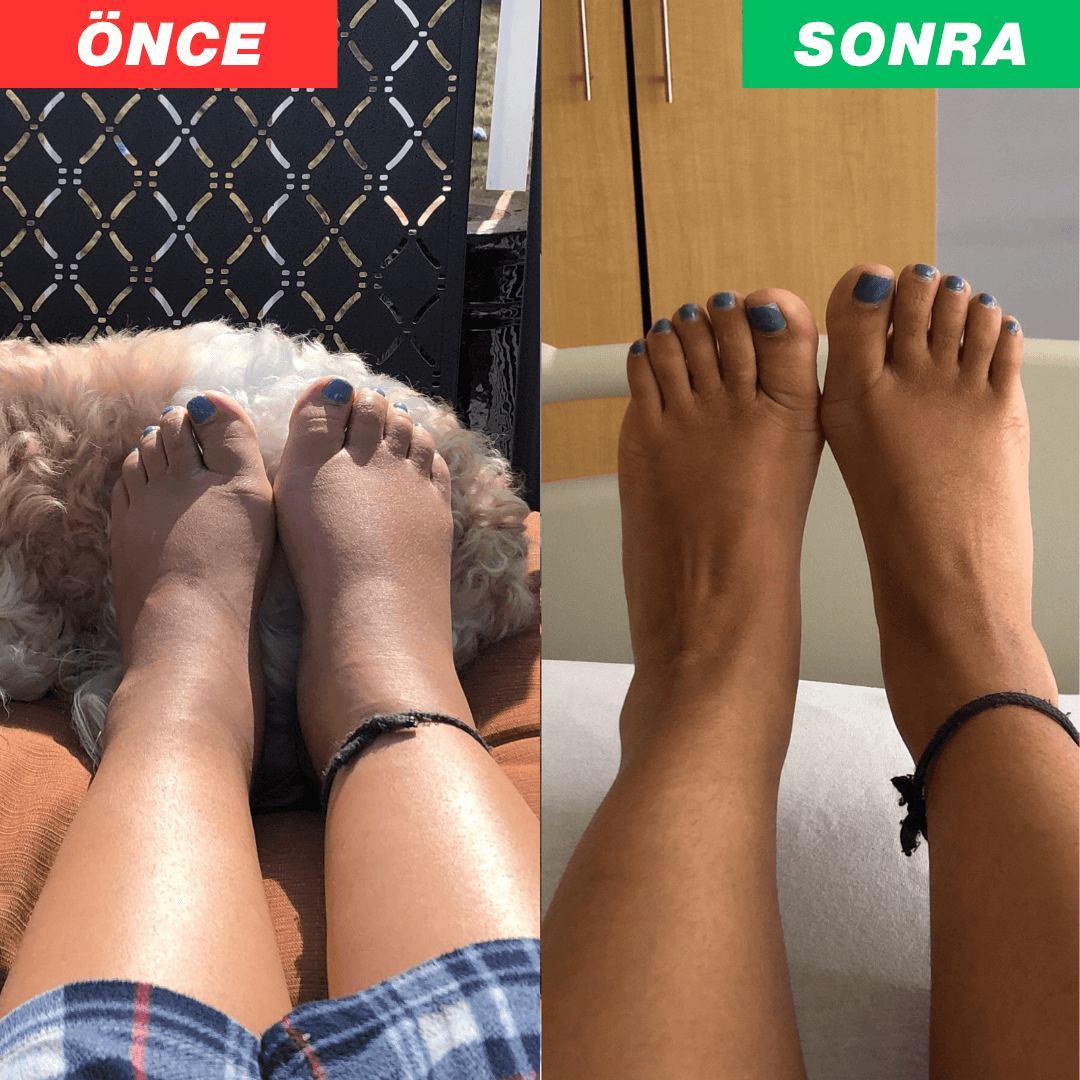 Voneras™ 3'ü Bir Arada Ayak Terapi Cihazı